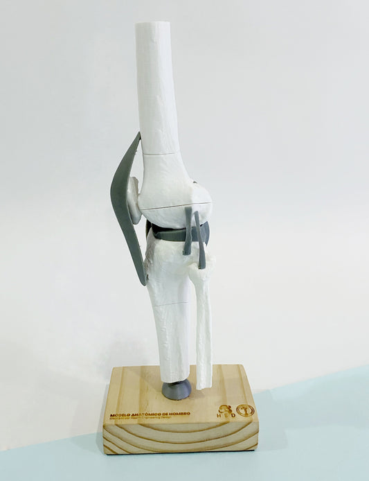 Modelo de Rodilla Fracturas