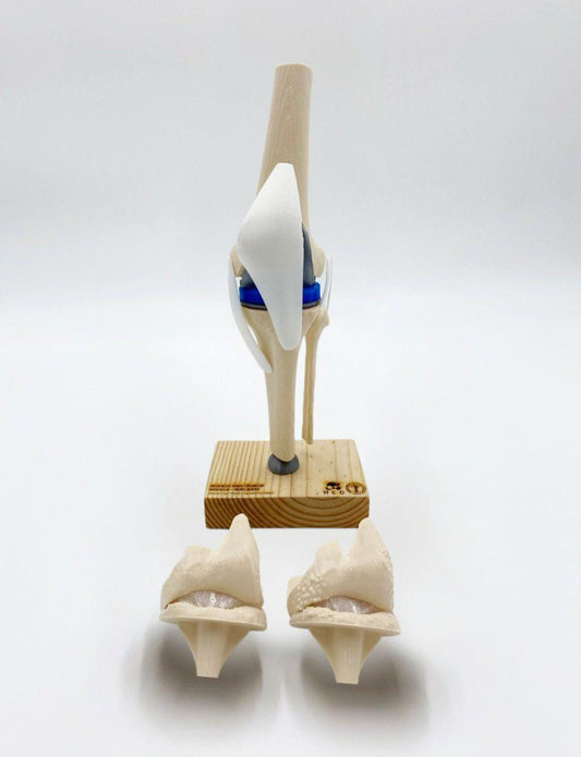 Modelo de Rodilla Implante